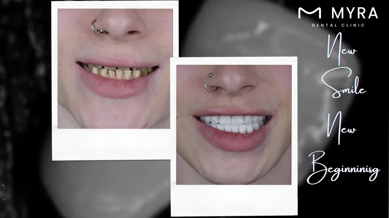 the overall benefits of a radiant white smile