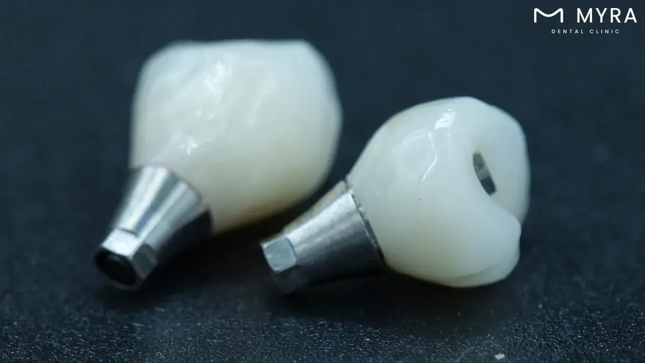 how is a custom-made abutment different from a stock abutment?