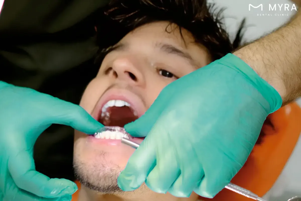 what are the things you can do with a gum shield?