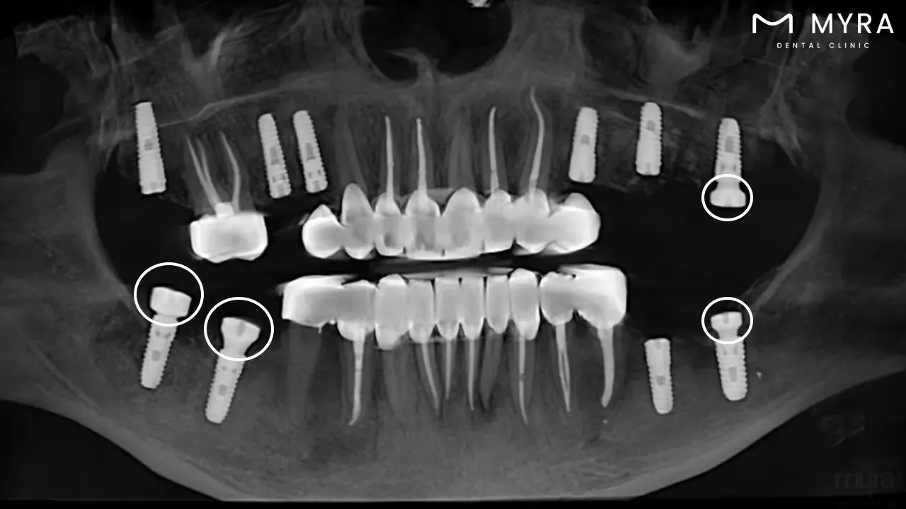 what are the benefits of a healing cap?