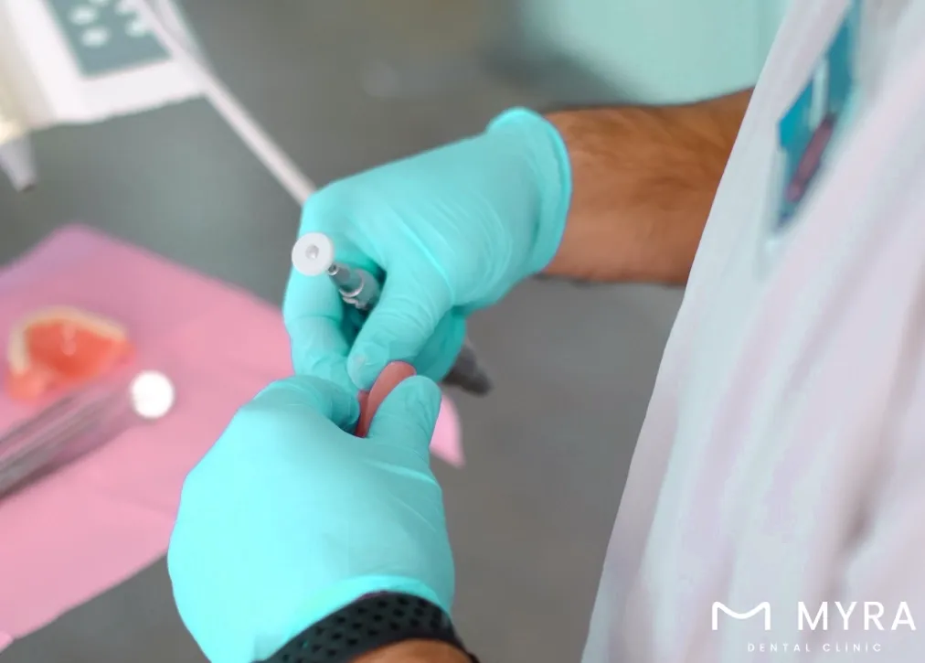 what are the cons of getting dentures in the usa?