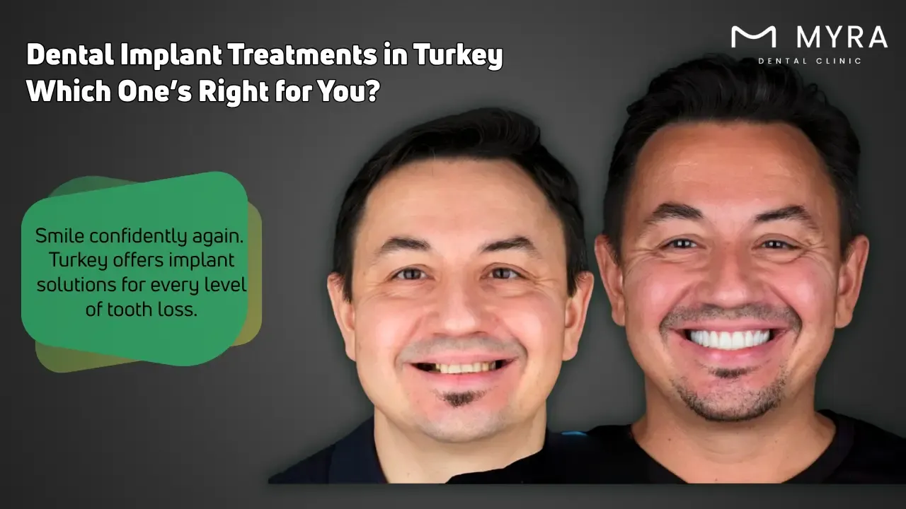what are the dental implants treatments in turkey