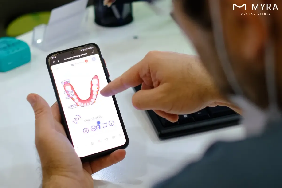 what is a gum shield?