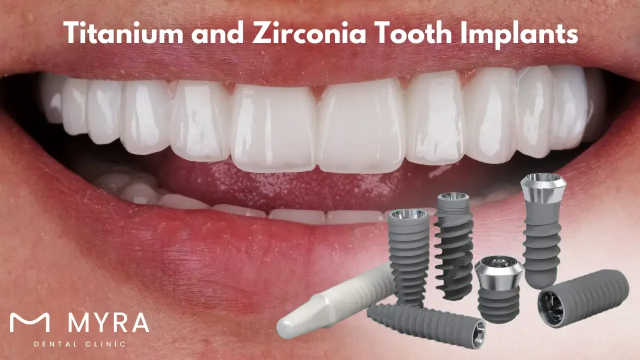 What.is.the.difference.between.Titanium.and.Zirconia.Tooth.Implants.in.turkey.webp