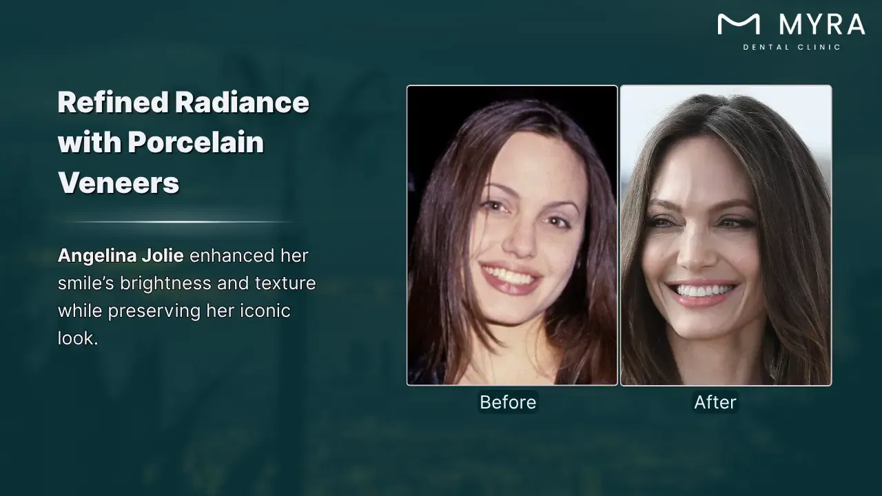 angelina jolie's smile