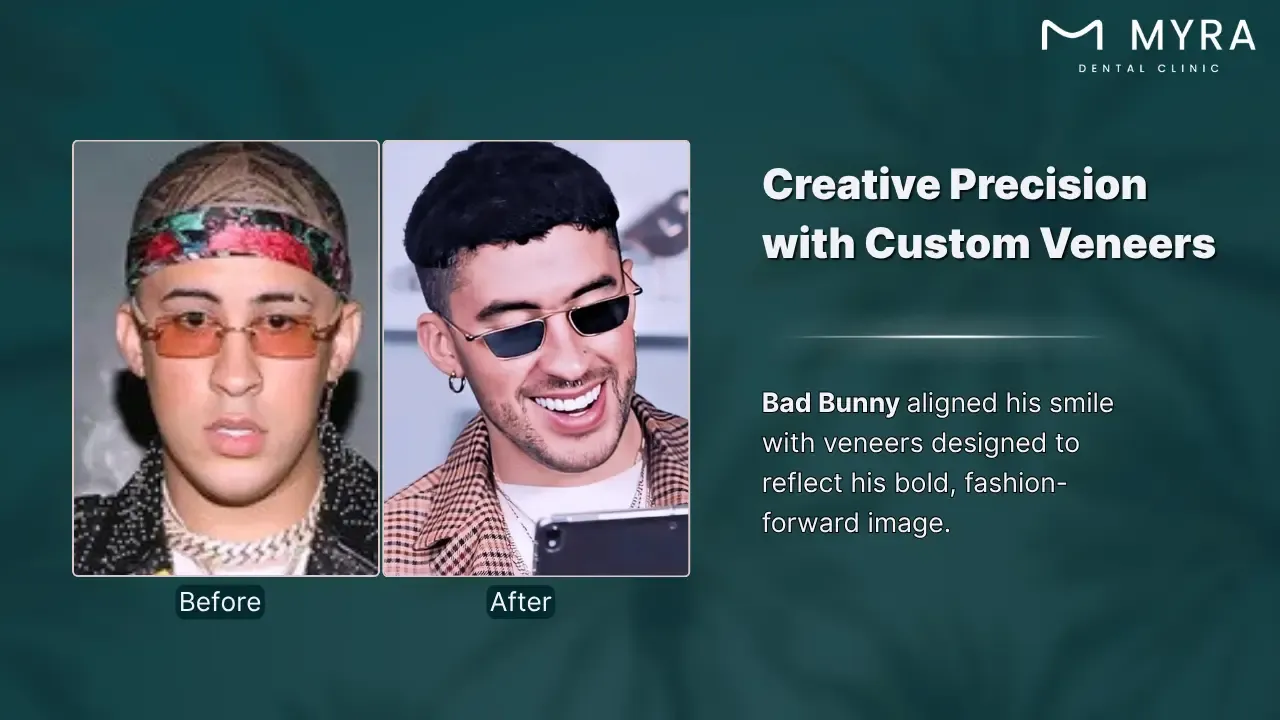 bad bunny's dental aesthetics