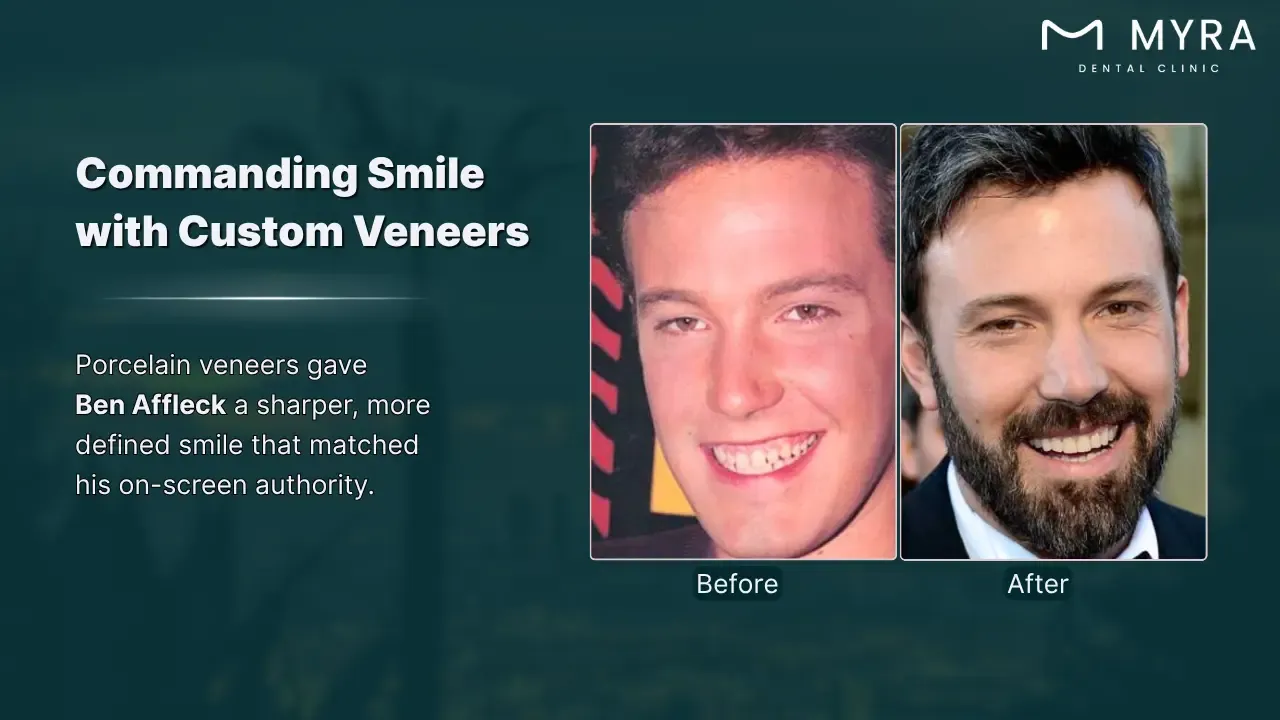 ben affleck's smile makeover