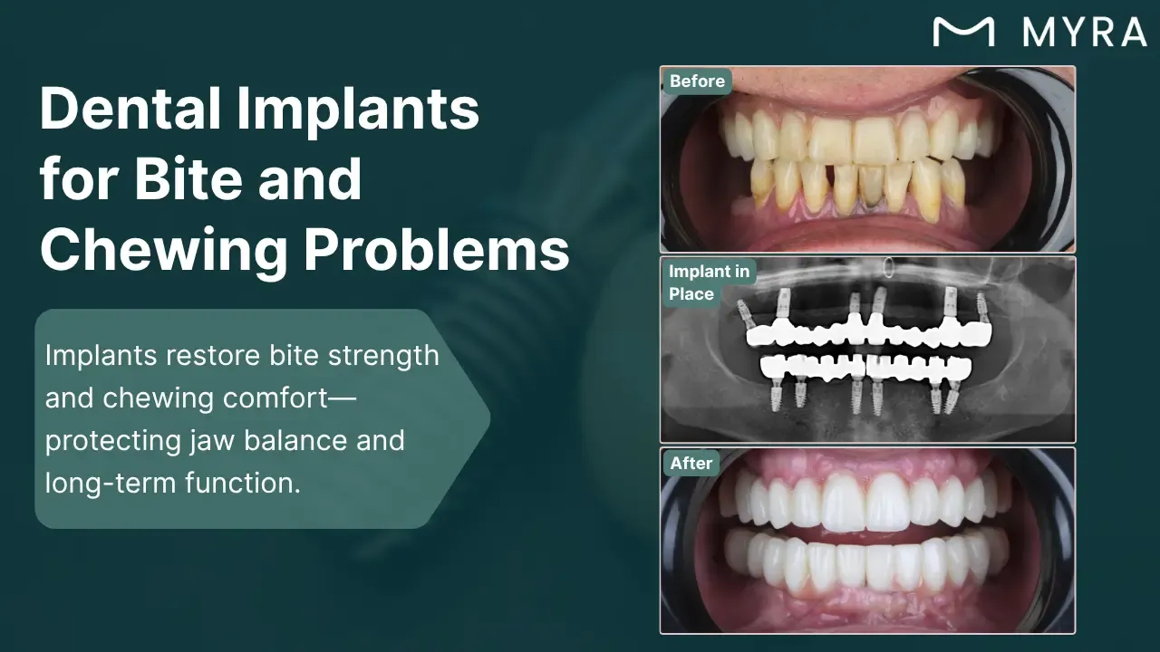 bite-and-chewing-issues.webp