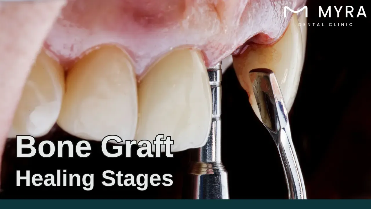 bone graft healing stages pictures