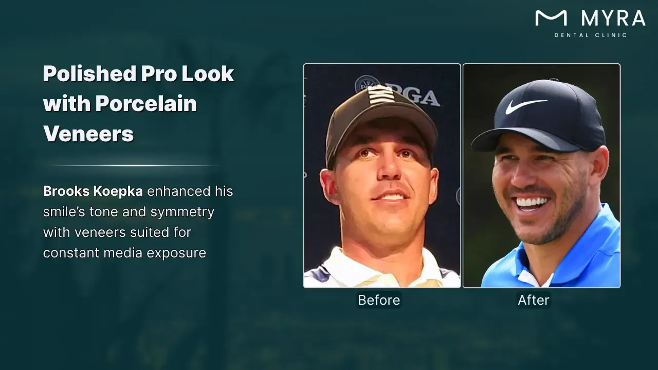 brooks koepka's smile