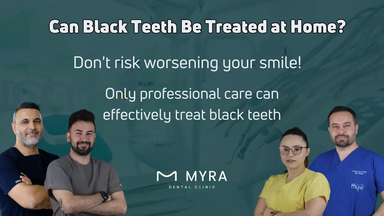 Can black teeth be treated at home?