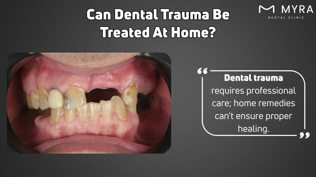 Can dental trauma be treated at home?