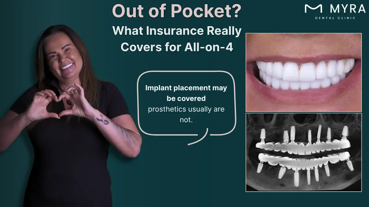 can insurance cover the cost of all-on-4 dental implants?