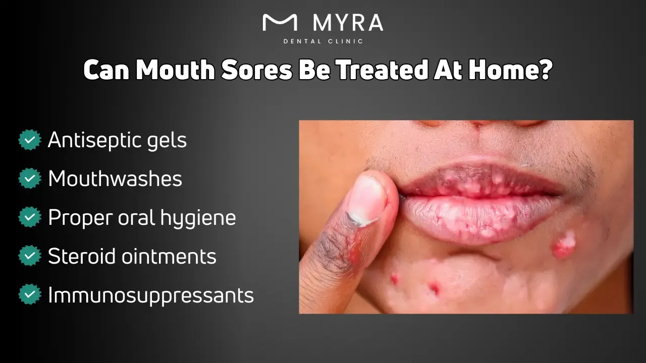Can mouth sores be treated at home?