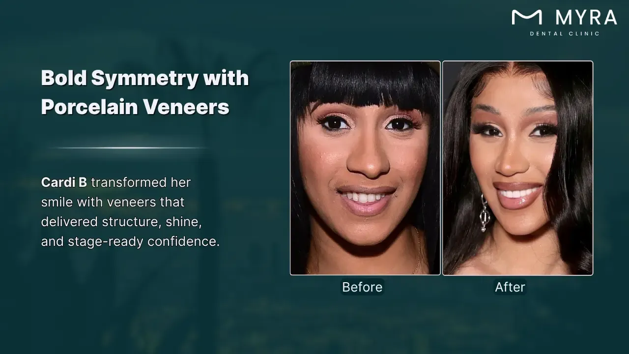 cardi b's dental transformation