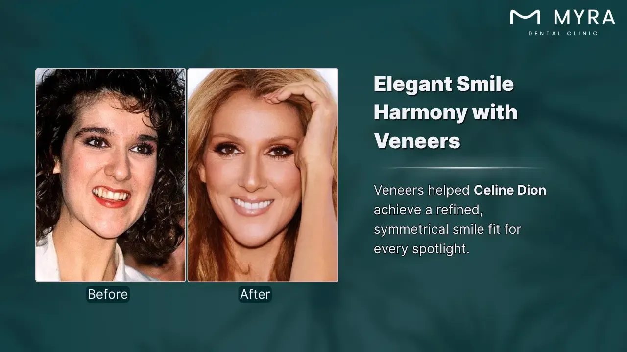 celine dion's smile evolution