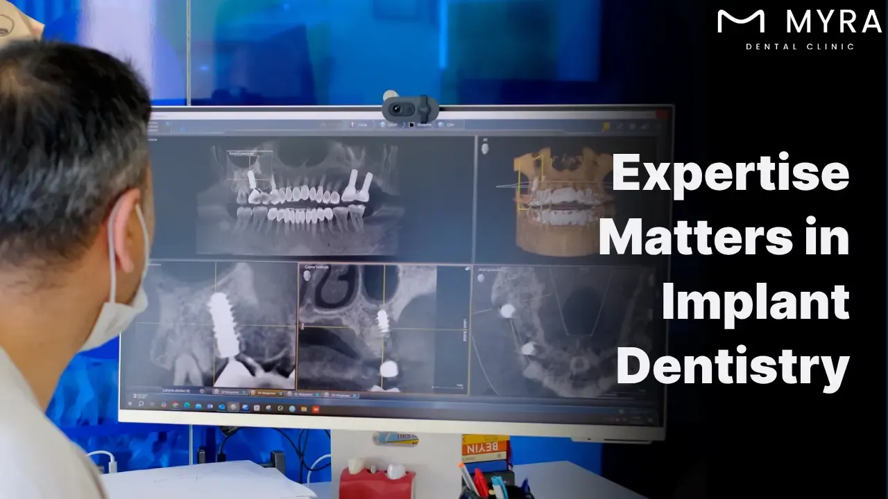 choose an experienced and certified dental implant provider