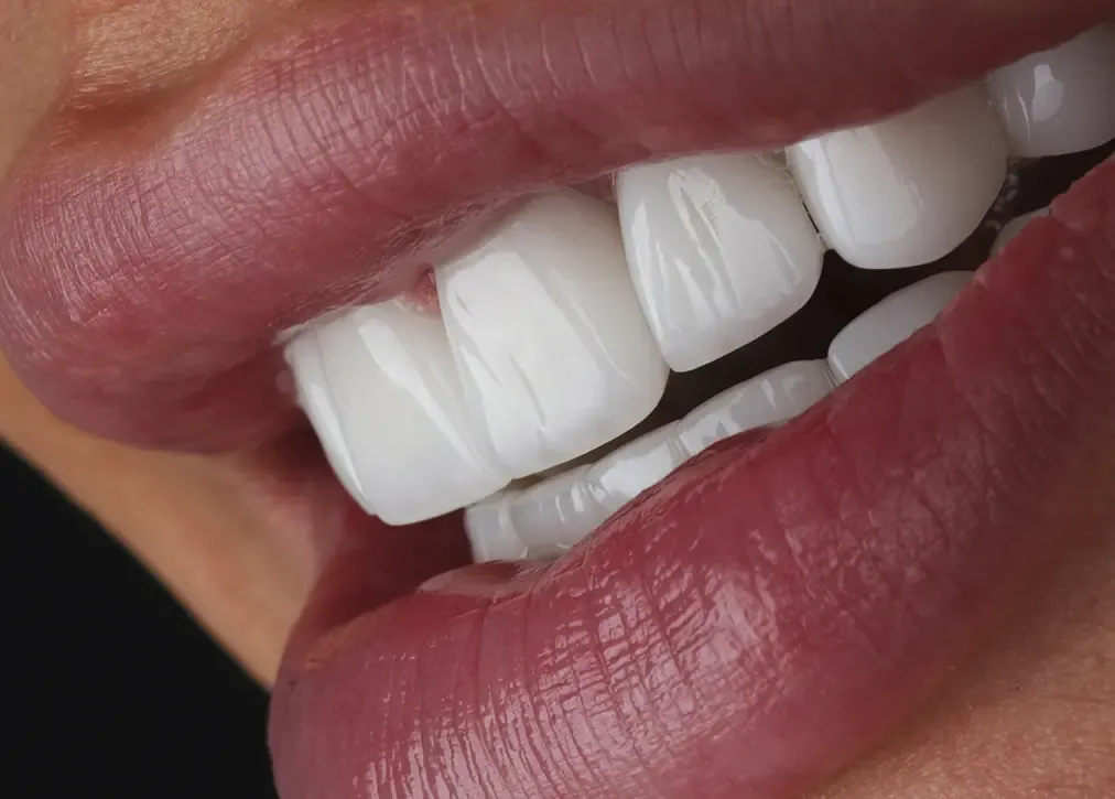 Complexity of the procedure