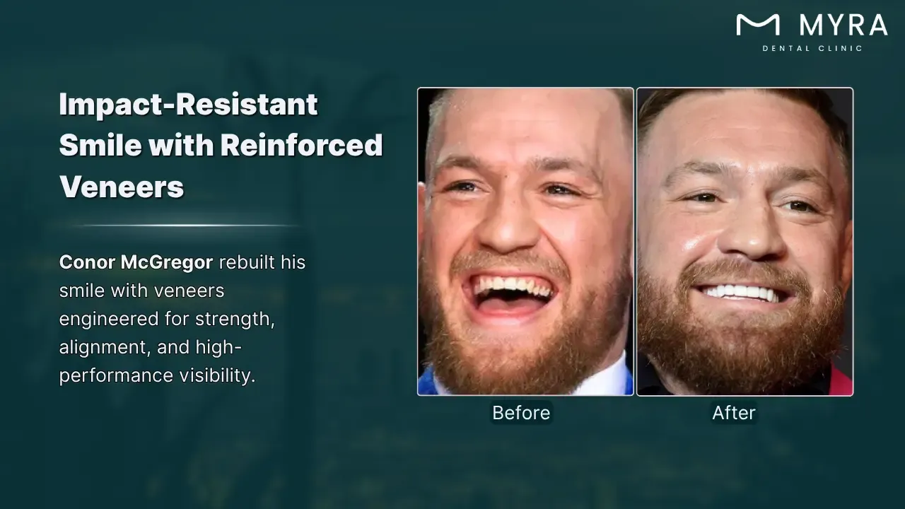conor mcgregor's bright smile