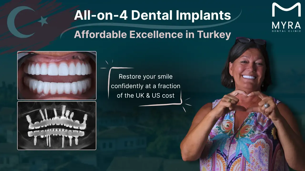 cost-of-all-on-4-dental-implants-in-turkey.webp