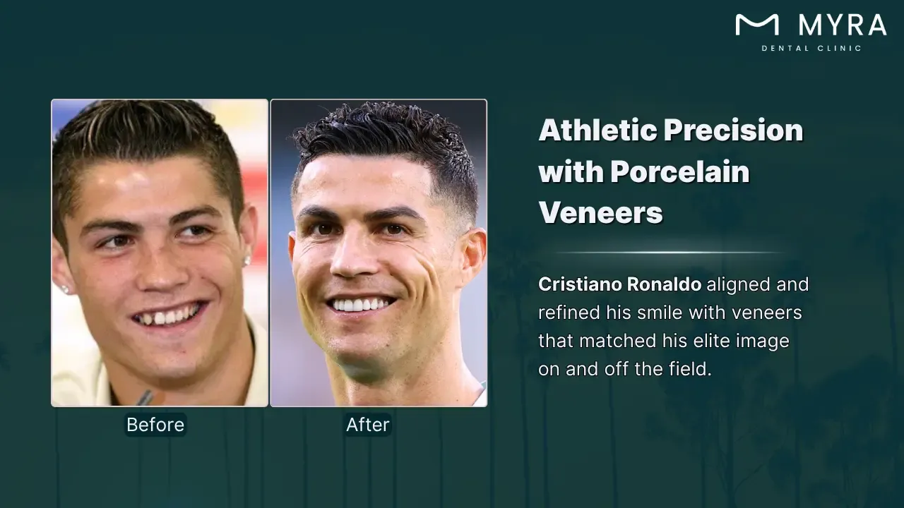 cristiano ronaldo's dental overhaul