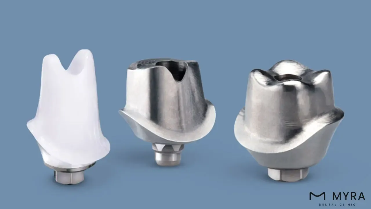 custom abutment