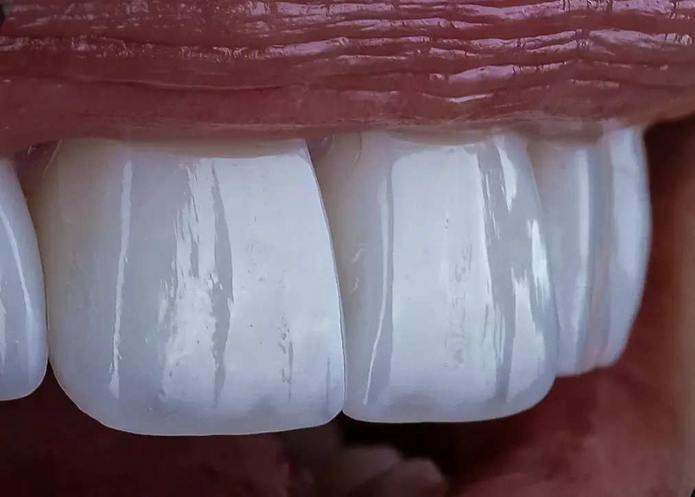 Dentist's expertise and reputation