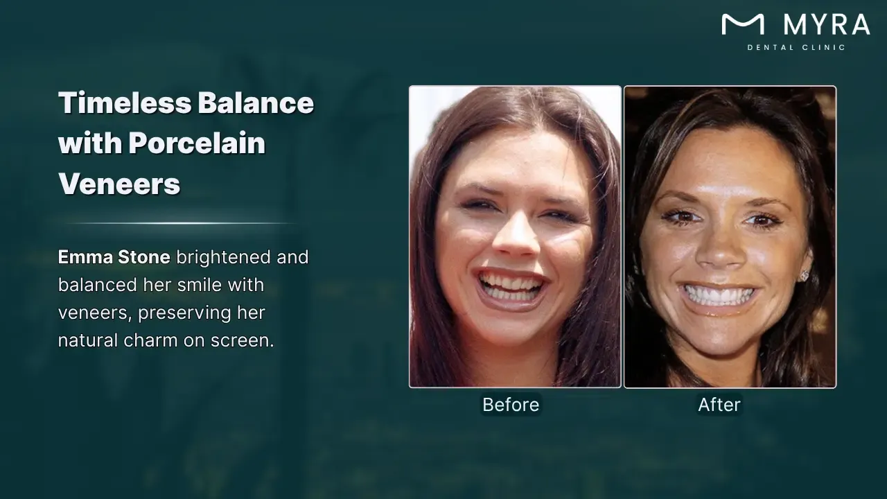 emma stone's natural-looking smile