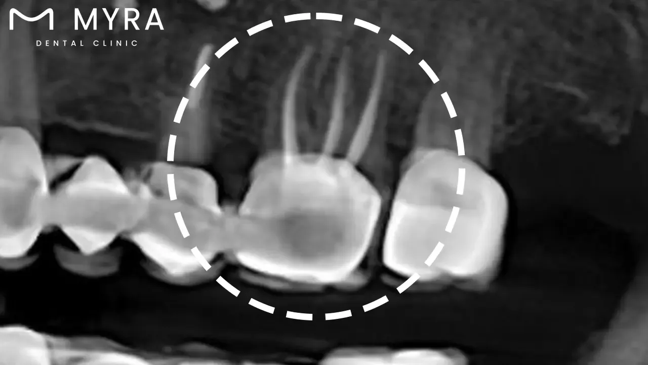Examination with x-rays