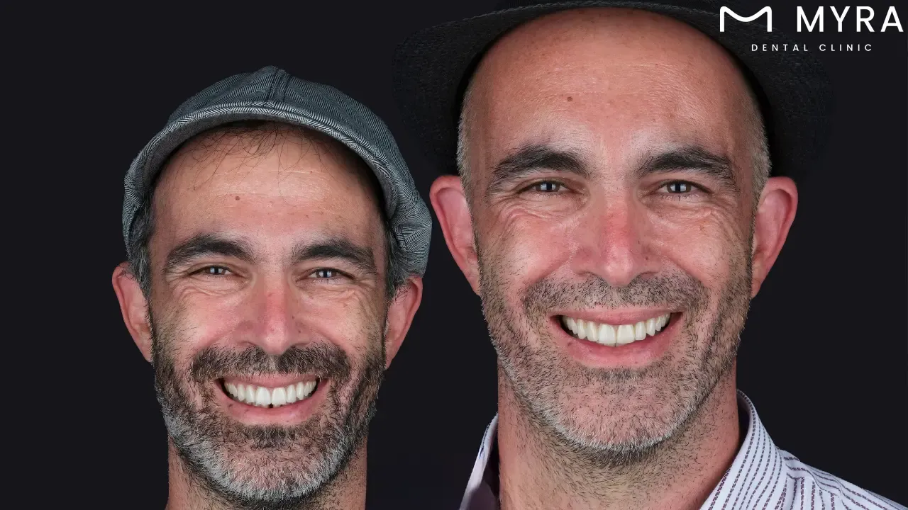 Exposure to certain pigmented substances in the environment