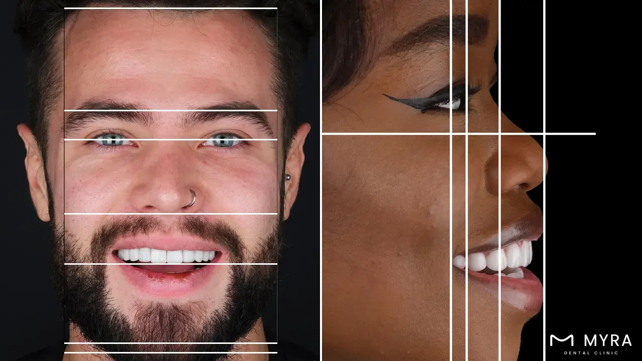 Facial analysis