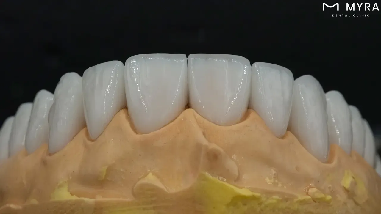 fitting and adjustment