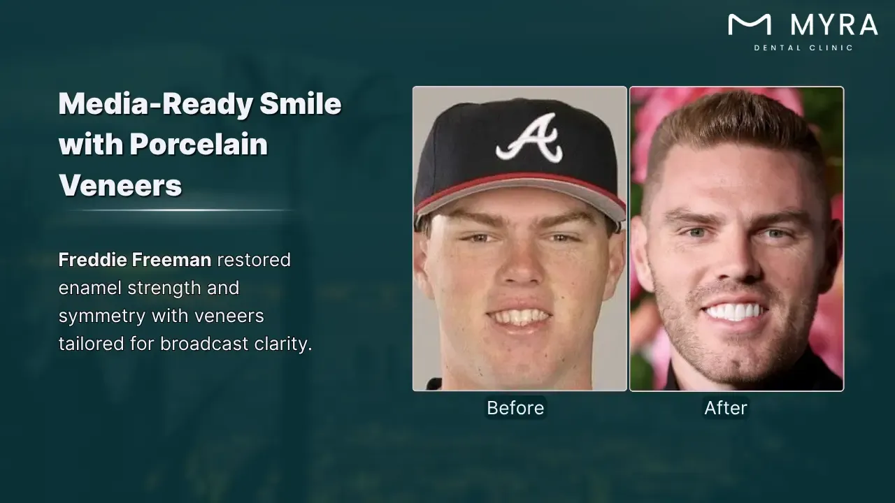 freddie freeman's smile