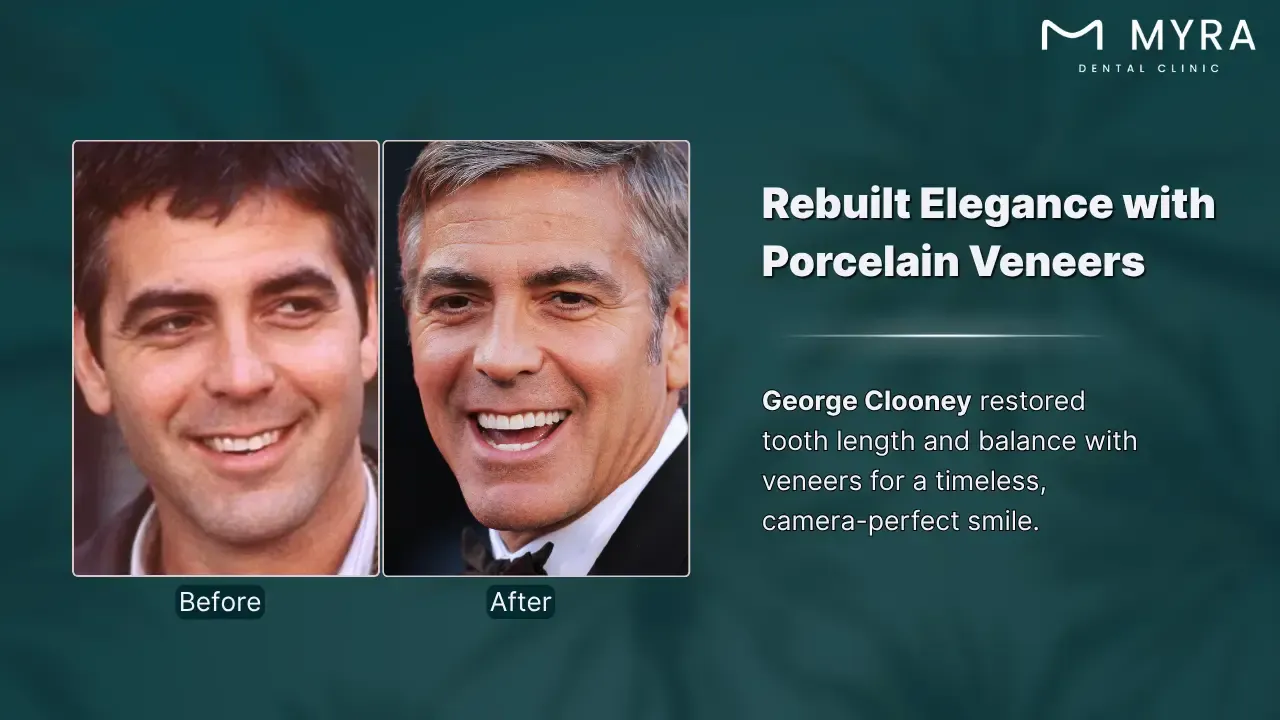 george clooney's charming smile
