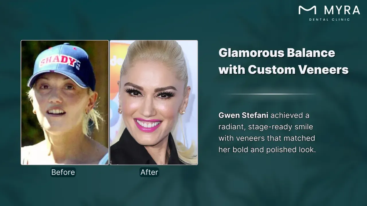 gwen stefani's smile journey
