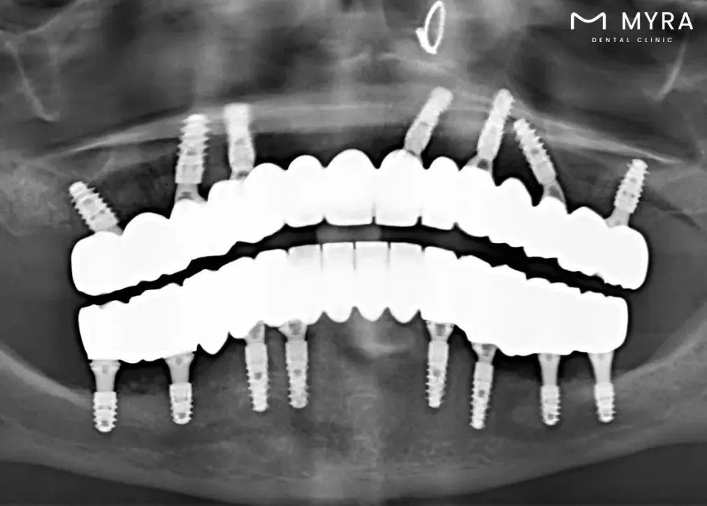 How does sirona 3d dental tomography help dentists?