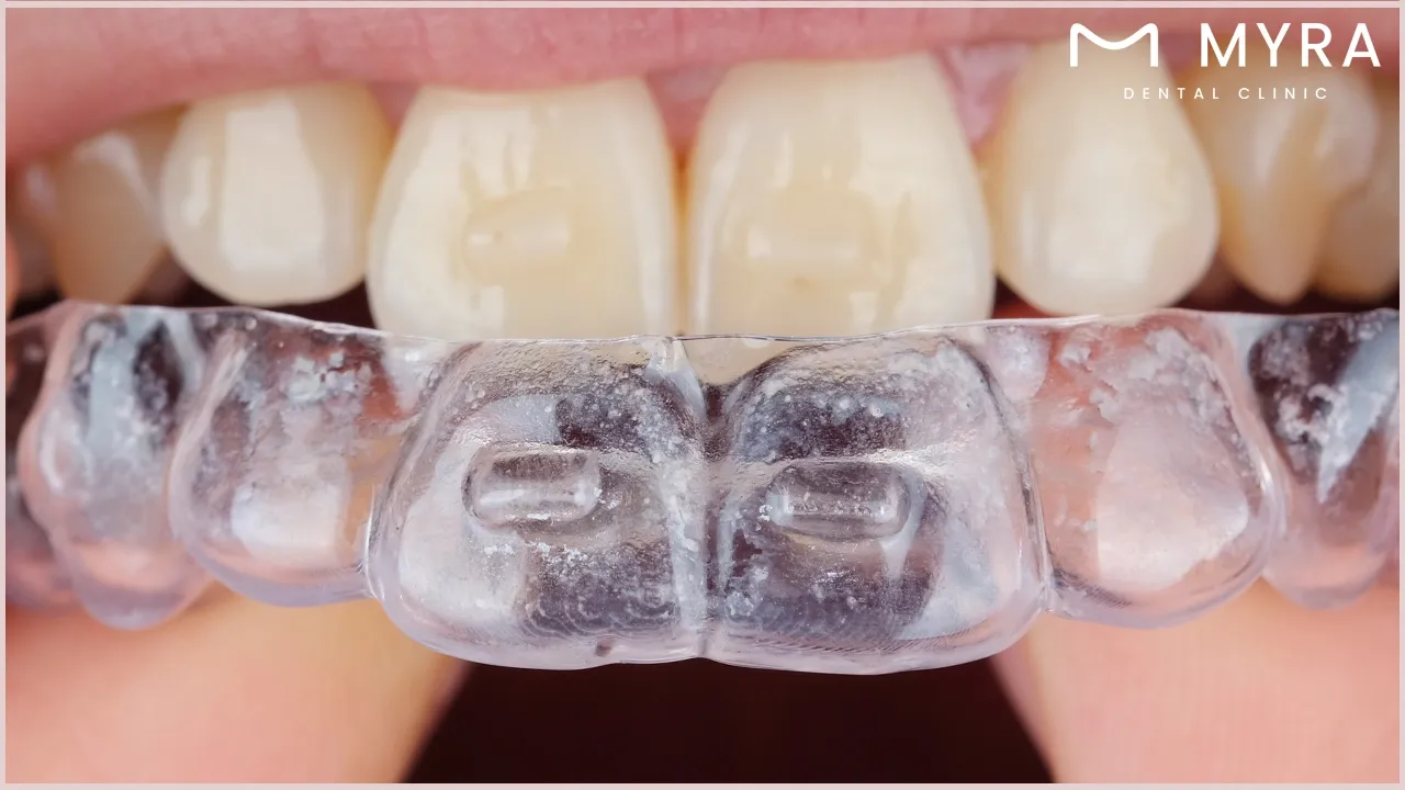 how is malocclusion diagnosed?