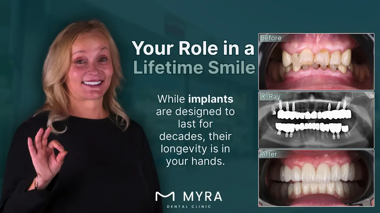 how long does a dental implant last?