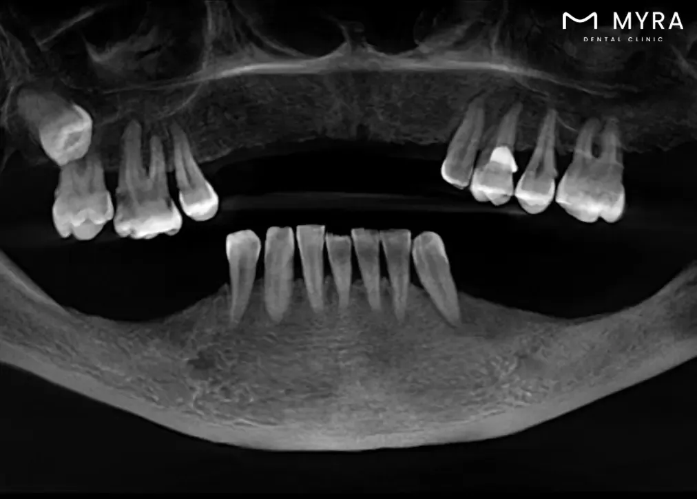 How long does a sirona 3d dental tomography scan take?