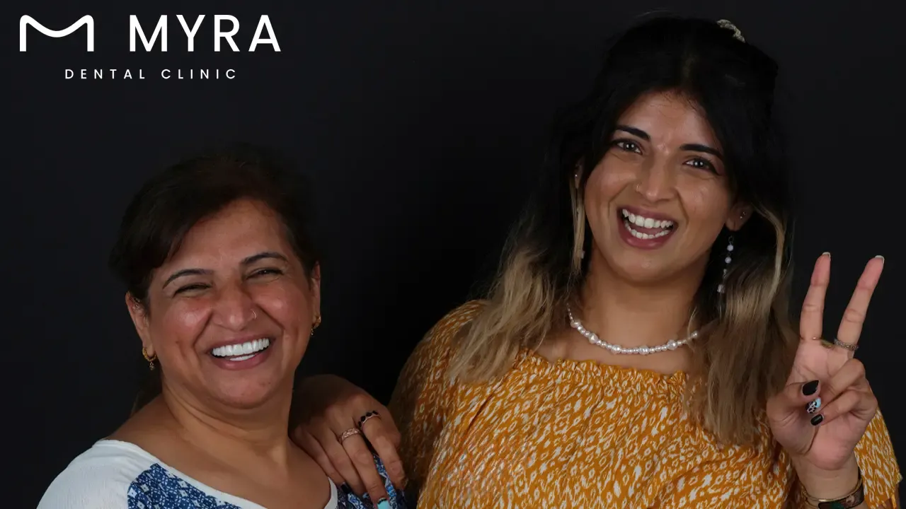 How much does a veneer cost in india