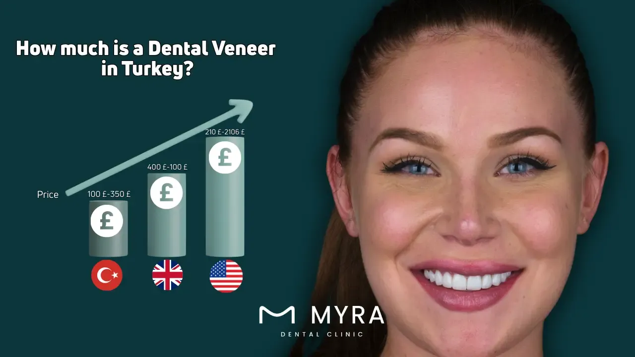 How much is a dental veneer in turkey?