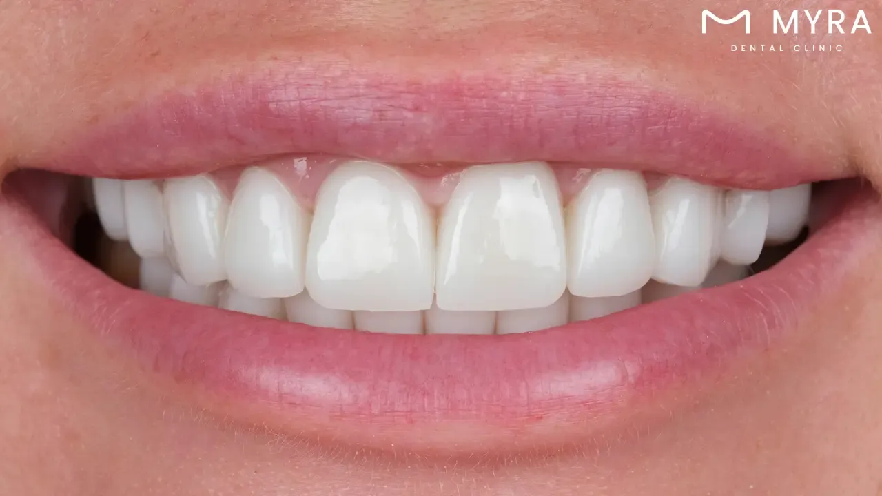 how often should dentures be cleaned?