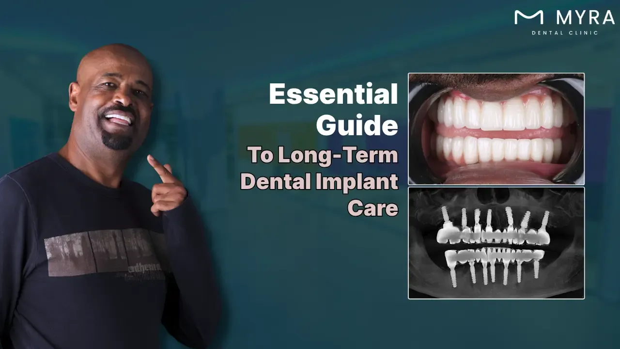 how to care for dental implants