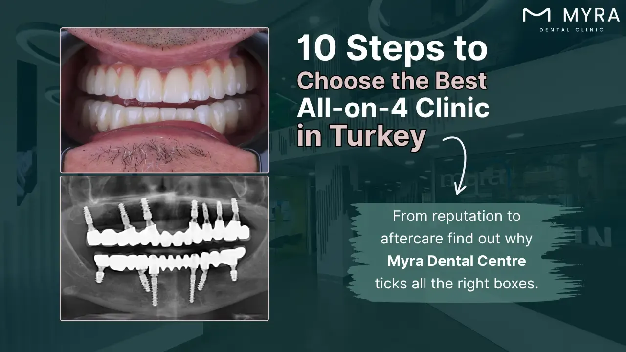 how-to-choose-the-right-clinic-for-all-on-4-dental-implants-in-turkey.webp