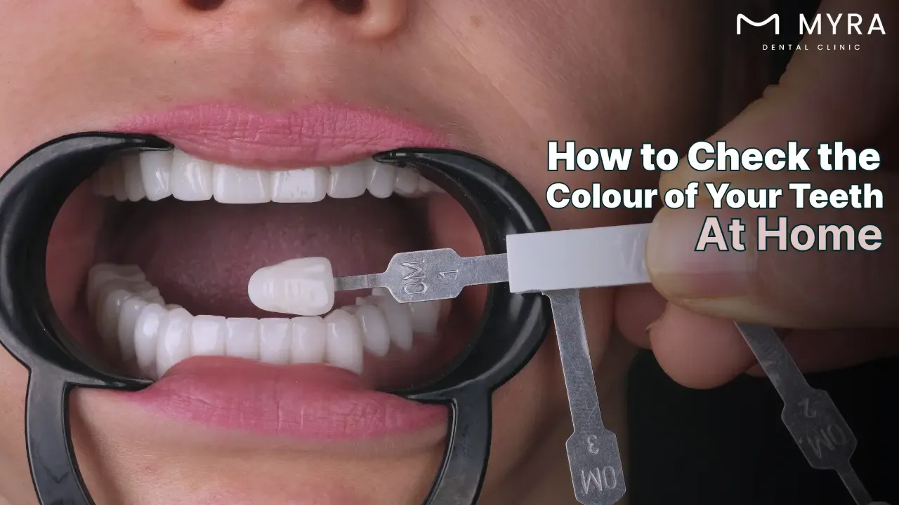 how to determine the colour of my teeth?