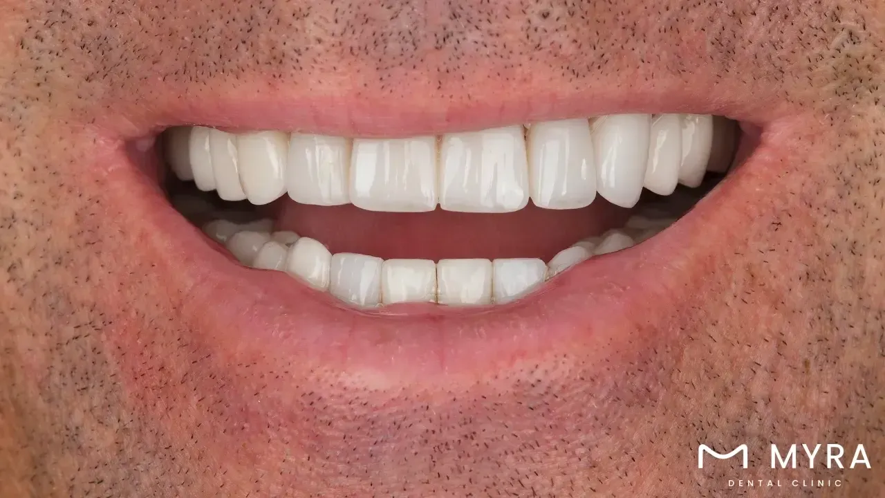 Insurance and financing options