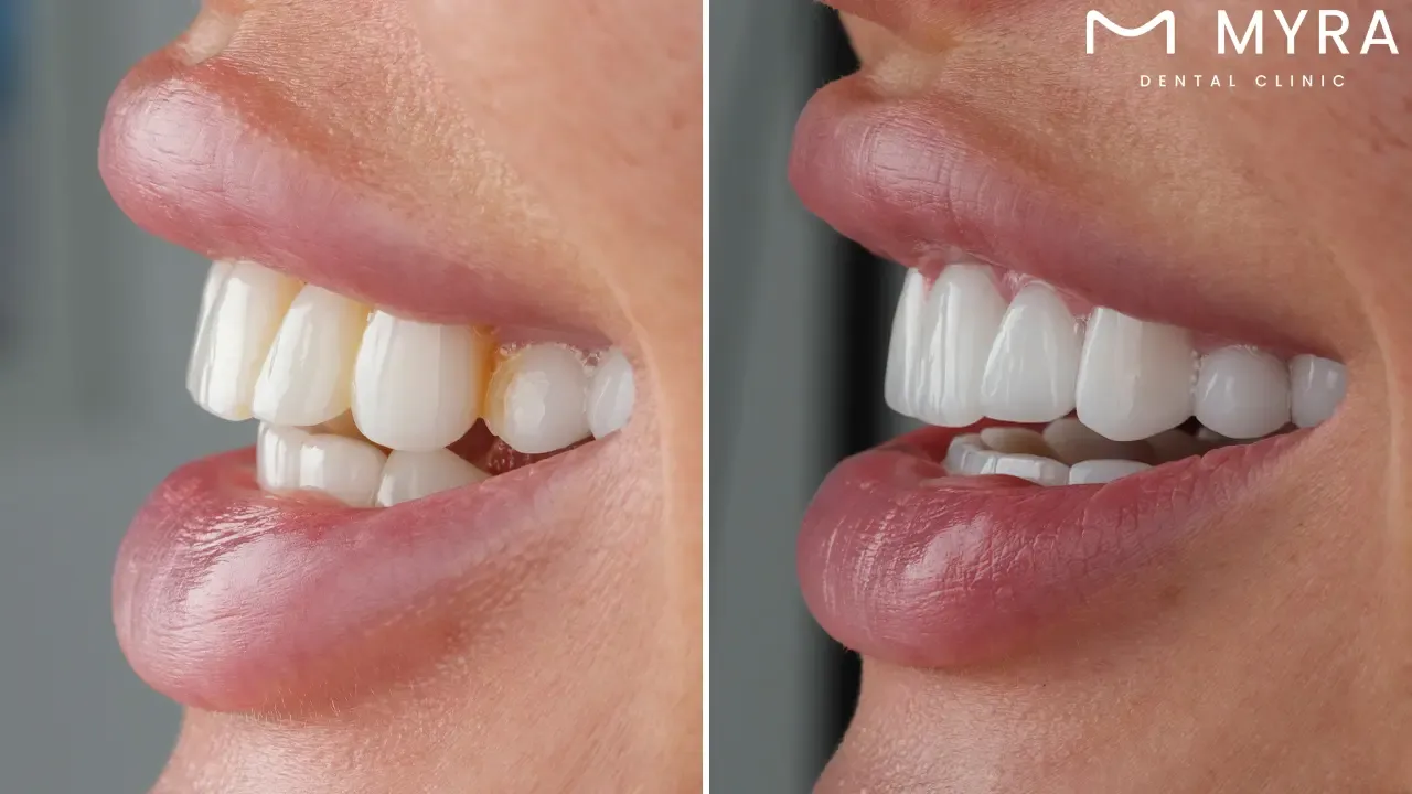  Irreversible procedure