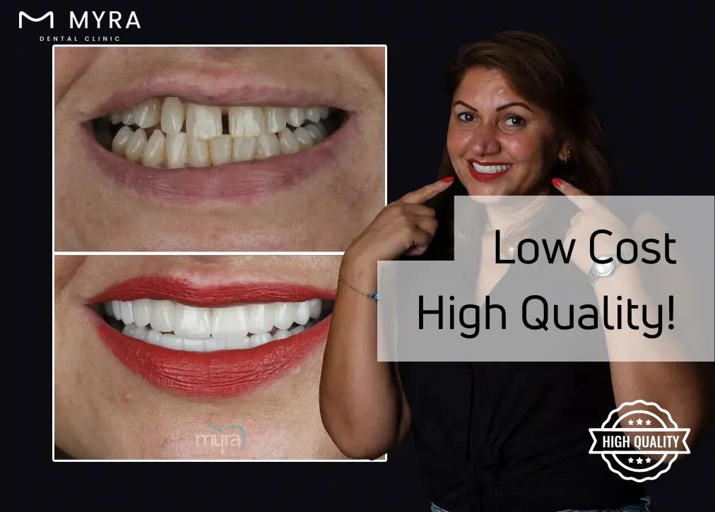 is dental treatment cheap in turkey?