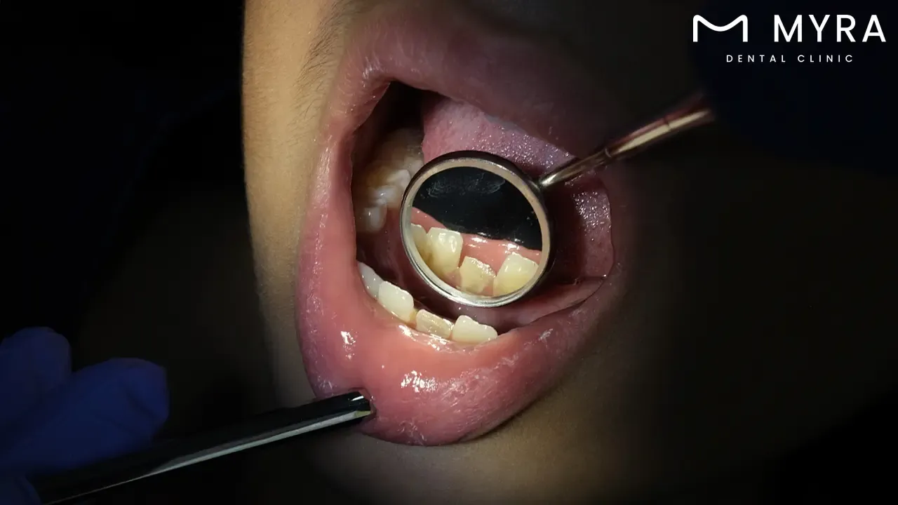 Is having treatment from a pedodontist expensive?