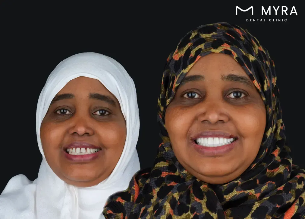 Is it haram to get your teeth done